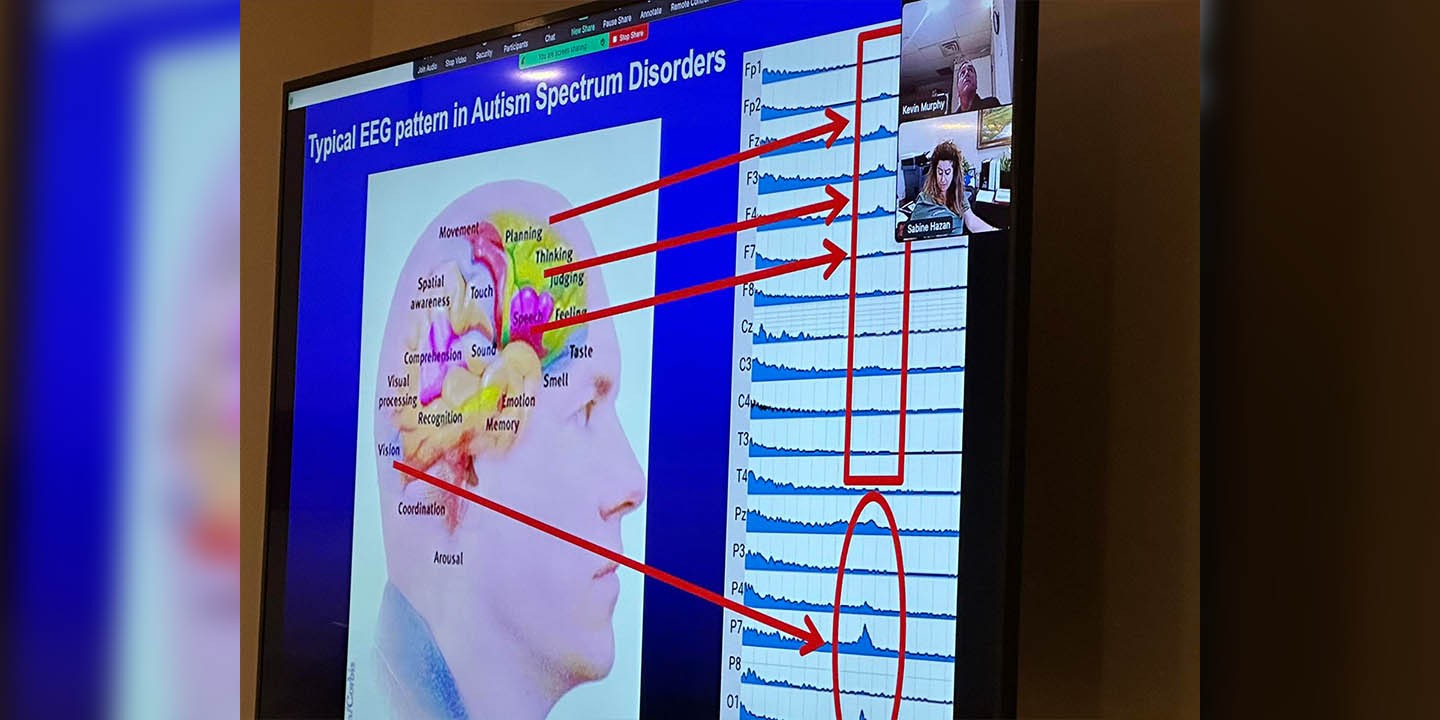 Otvorena revolucionarna klinika "R Hope Treatment" za neurološke poremećaje u Evanstonu, Ilinois